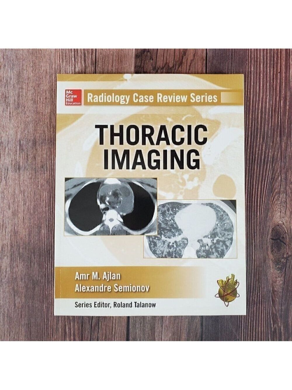 Radiology Case Review Series: Thoracic Imaging by Alexander Semionov (Paperback)